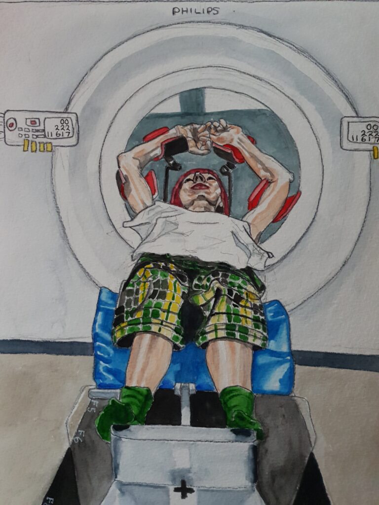 ID Me viewed from the foot end. I am lying on my back with my knees raised up on a blue wedge. I have a white piece of paper covering my top half. Im wearing green, yellow and black, tartan cropped trousers and green socks. My hair is dyed poppy red and My arms are above my head, being supported at the bicep and wrist, with supports to help me hold the position required for the radiotherapy. Behind me is a large donought hole which the "bed" im on is about to be fed into - this is the CT scanner. I have a metal stop at my feet to hold me in position. On either side of hte donought is a rectangluar thing with buttons and numbers on it, the numbers match on both sides. The table/bed Im resting on is black with a clear shape over the top of it. The clear shape on top, narrows as it comes towards you. Down the side of the table is written F5, F6 and F7