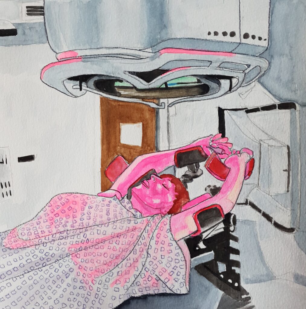 ID Me in hospital gown lying on the radiotherapy bed, I have my arms above my head supported on 4 supports and the radiotherpy machine is above me, though it moves round you when you are having treatment.